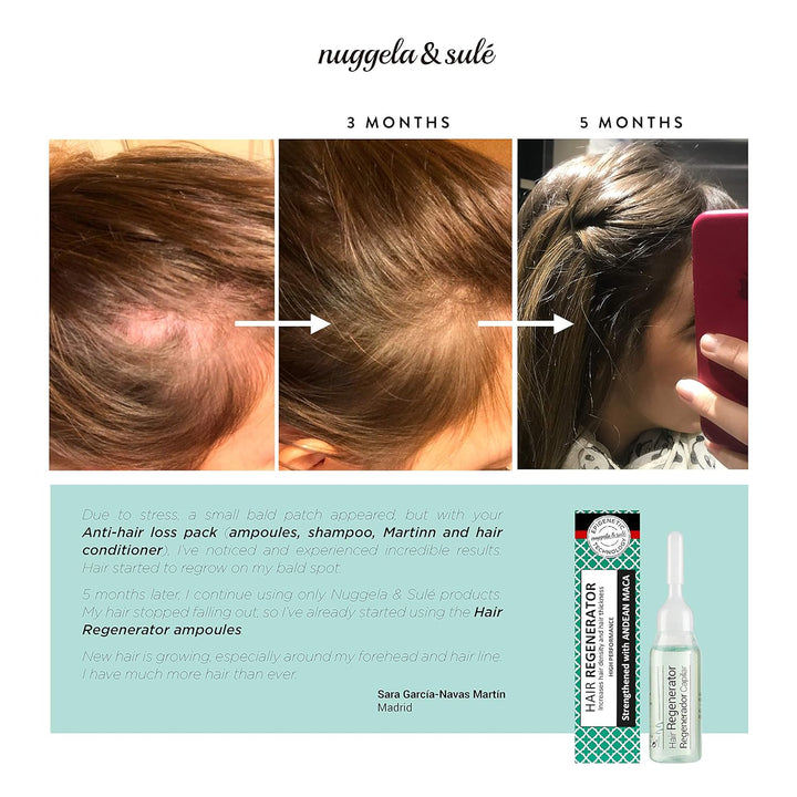 Nuggela & Sulé Haar-Regenerator Ampullen. Effektive Behandlung. Mit Anden-Maca Und Marinem Glykogen. Erhöht Haardichte Und -Stärke. Besonders Für Lichte Haarpartien Geeignet. 4-Wochen-Kur. 4 X 10 Ml